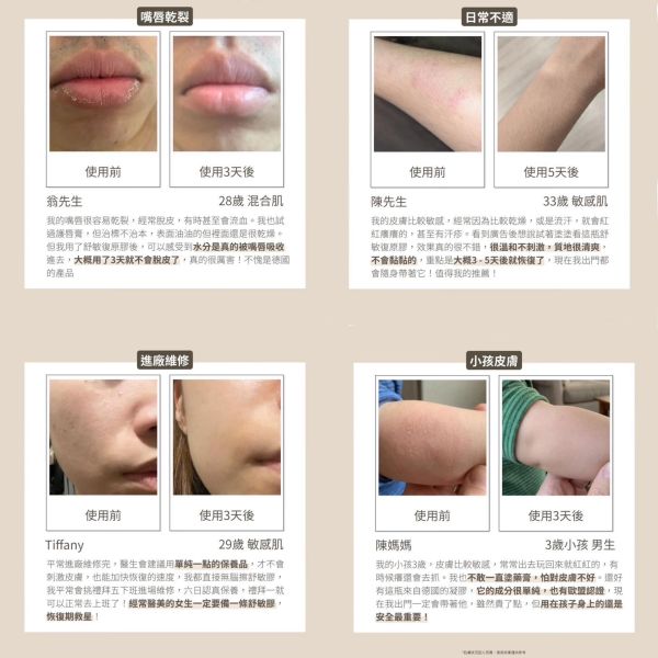 德國 CHRIS FARRELL 舒敏復原膠 