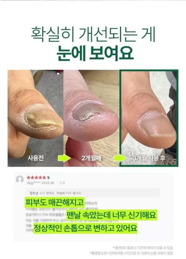 爛甲挽救神器Liz Fussklar 一滴護指甲滋養精華液 