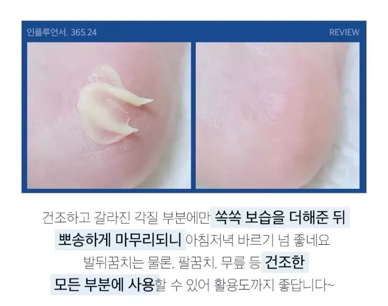 Medi - Peel Egf 修復護足霜 