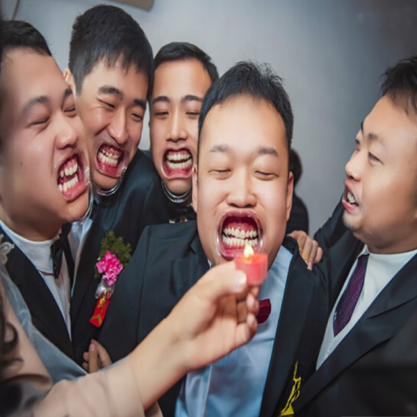 牙套闊嘴器 牙套闊嘴器,裝扮道具,派對道具,生日氣球,生日佈置,春酒,尾牙,派對,慶生佈置,派對佈置,畢業,畢業布置