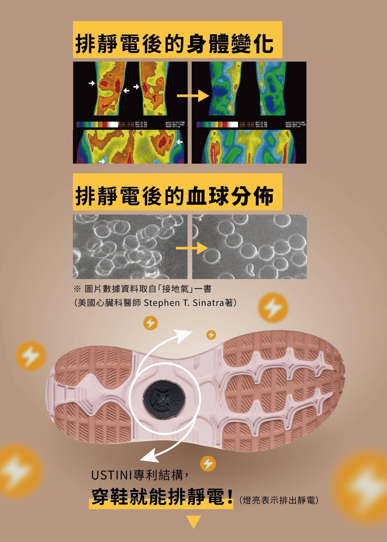 “USTINI我挺你健康鞋小美極地鞋排靜電鞋”