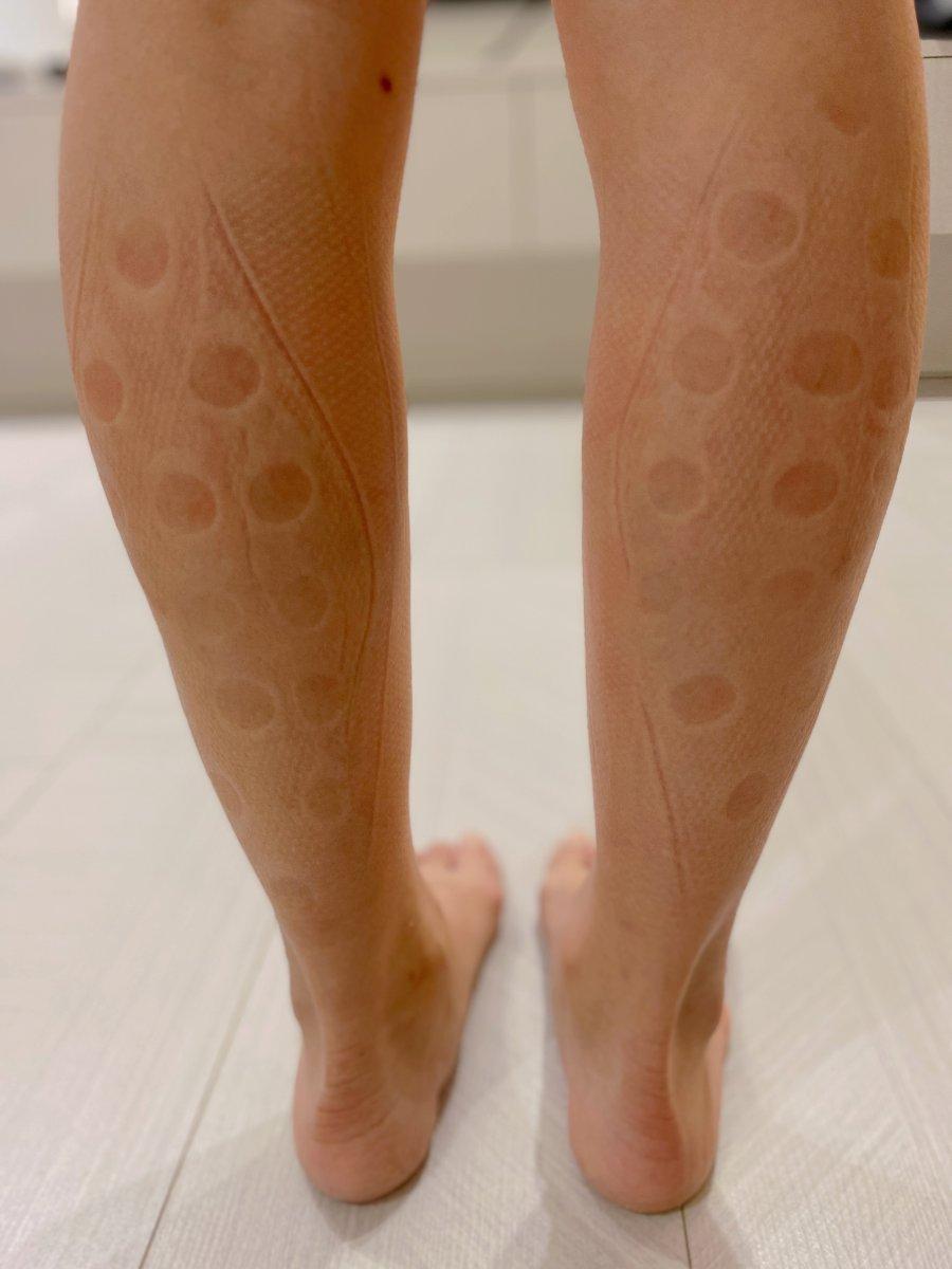 好腿力 按摩後的小腿