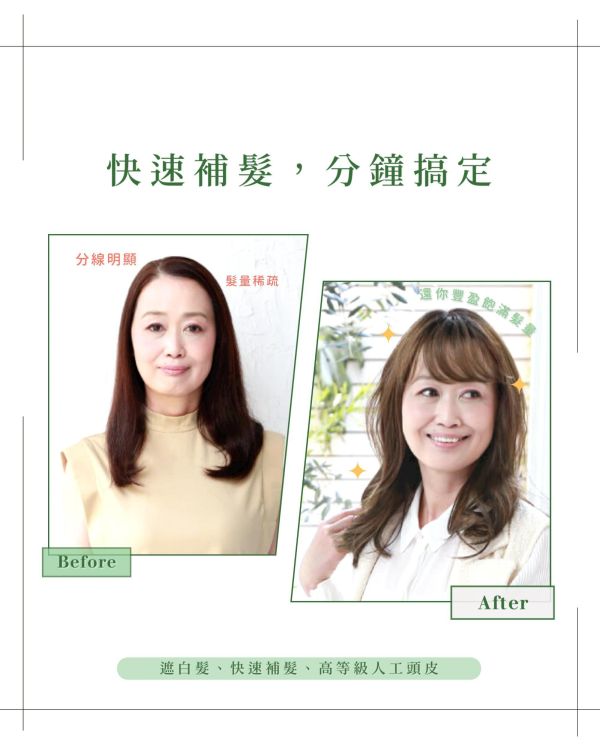 大範圍遮白髮片｜瀏海手工+I型人工頭皮 ｜髮質自然超逼真 日本進口 染髮,遮白髮,補髮量,假髮,頭頂補髮片