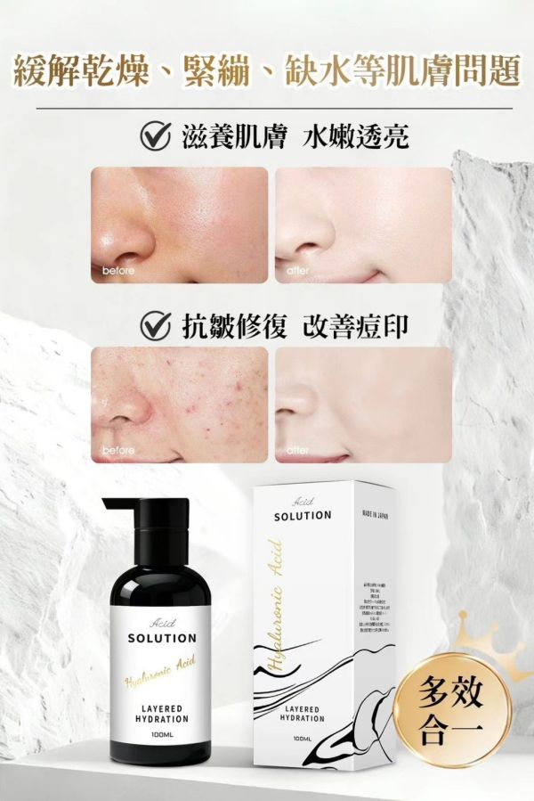 優安抗皺修復玻尿酸原液(一組3入) 