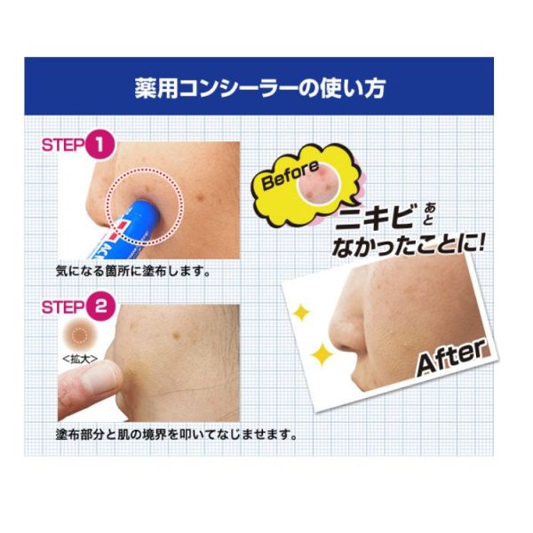 ACNE BARRIER 男用遮瑕膏 5g/個 