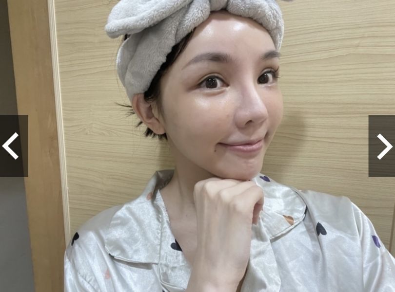 痘印殺手♡肌膚未來377嫩白精華液 
