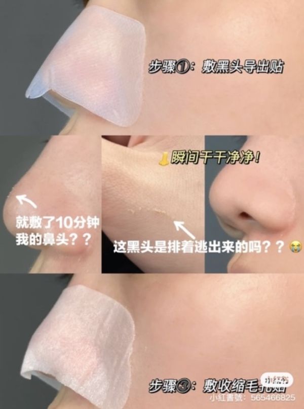 EIIO黑頭鼻貼♡無情鏟黑頭 