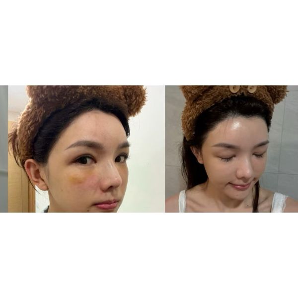 麗珠蘭成分PDRN修復霜 