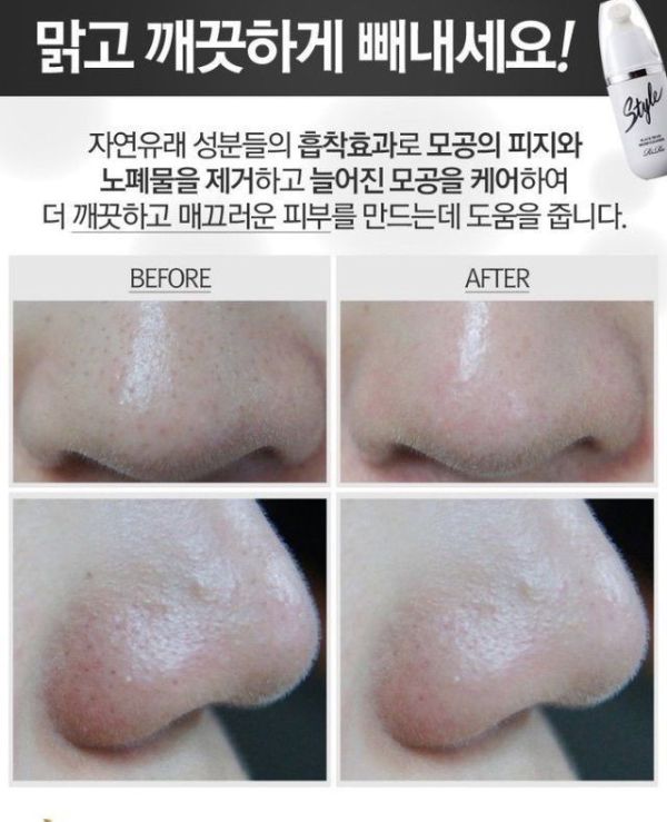 RiRe毛孔黑頭粉刺潔面刷 20ml 