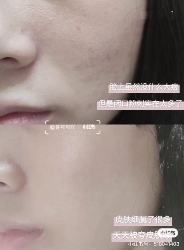 磨皮素顏肌-PMPM海茴香棉片 