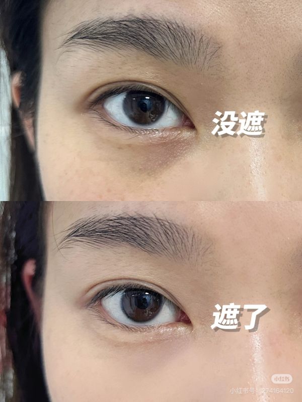 The YEON Ectoin超能依克因遮瑕+眼霜 