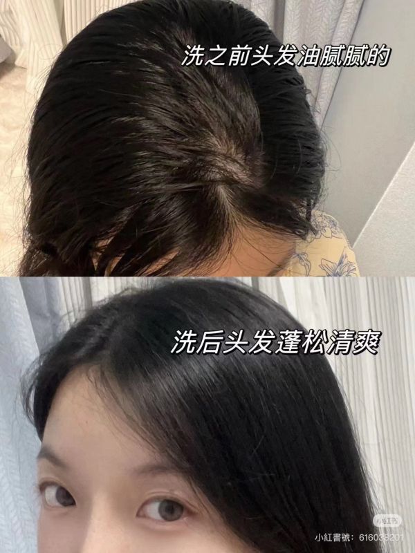 TS無硅油強健髮根/活絡毛髮洗發精500ml 