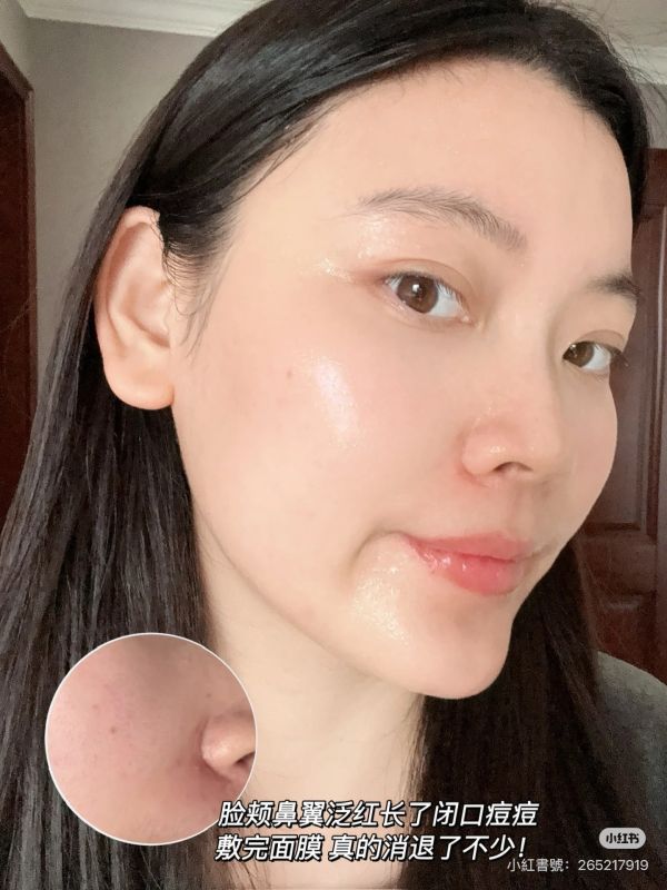 豆肌修復-Abib口香糖魚腥草面膜 