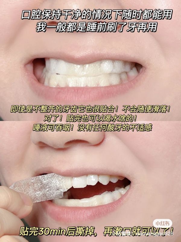 BOP酵素鎖白牙貼 