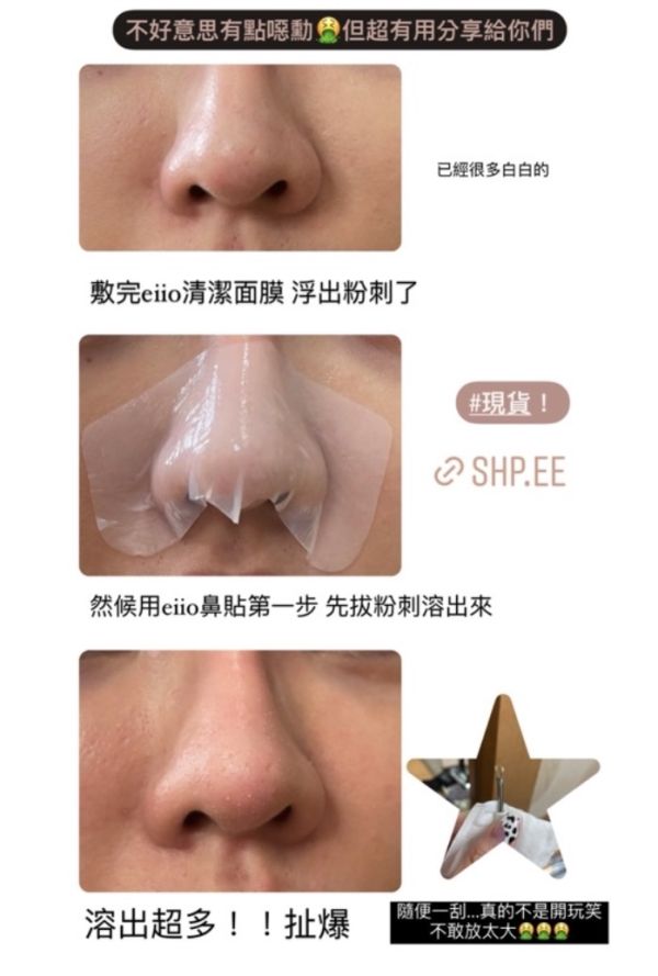 EIIO黑頭鼻貼♡無情鏟黑頭 