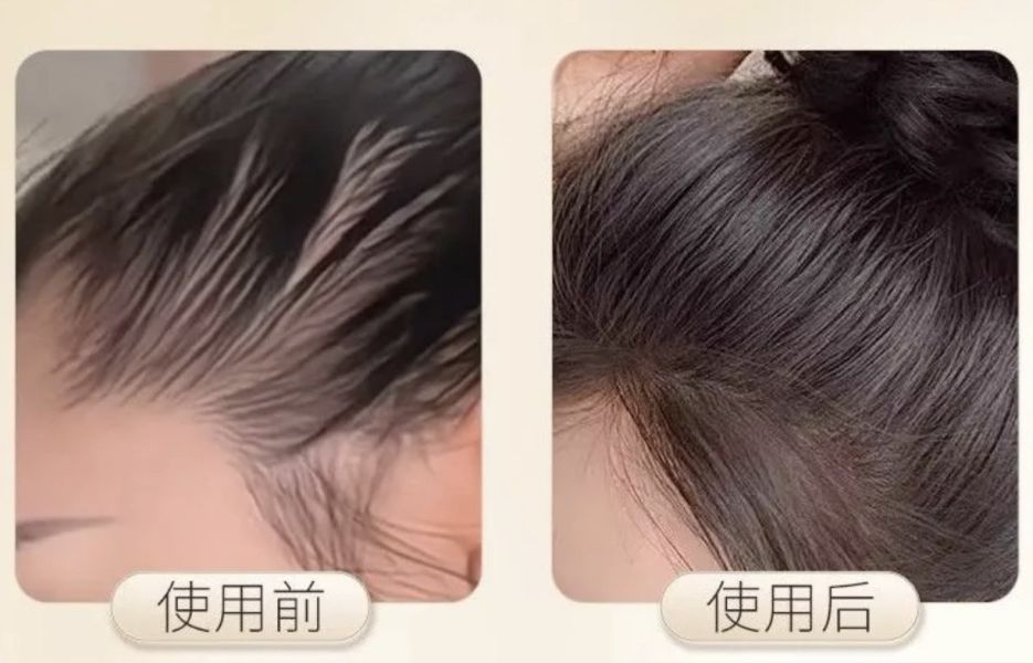 髮縫神器-豬鬃毛三排窄齒梳 