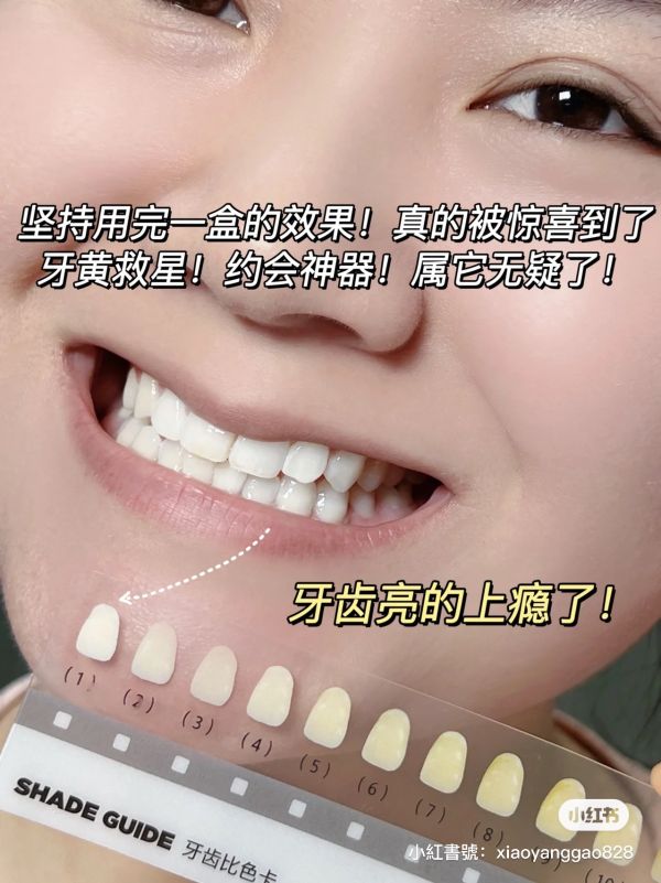 BOP酵素鎖白牙貼 