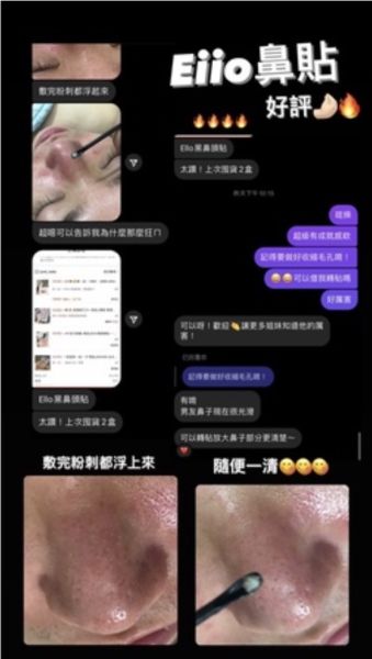 EIIO黑頭鼻貼♡無情鏟黑頭 