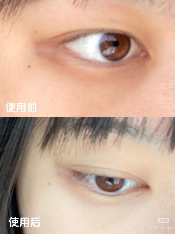 The YEON Ectoin超能依克因遮瑕+眼霜 