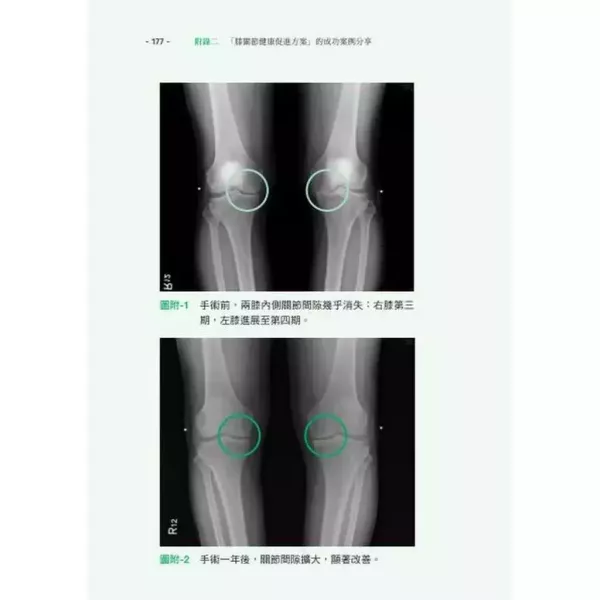 自己的膝蓋自己救 自己的膝蓋自己救：退化性膝關節炎的真相,暢銷書,醫療保健,時報,