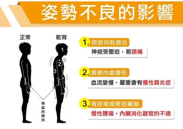 【YAMAKAWA】姿勢矯正背帶/挺背帶/8字型設計 姿勢矯正背帶,挺背帶,8字型設計,YAMAKAWA,台灣暢銷,台灣,矯正背帶,背帶,支撐,防駝背矯正帶,圓肩,高低肩,脊椎不正,腰背不適,背部痠痛