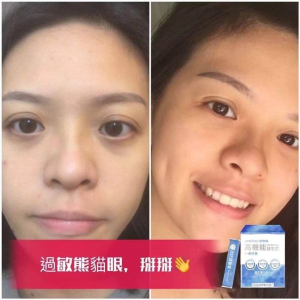 【年終慶】高機能益生菌和晶亮凍超值組 【夏日對策】水光繃帶面膜精裝盒超值組,水光繃帶面膜,水光面膜,婕樂纖