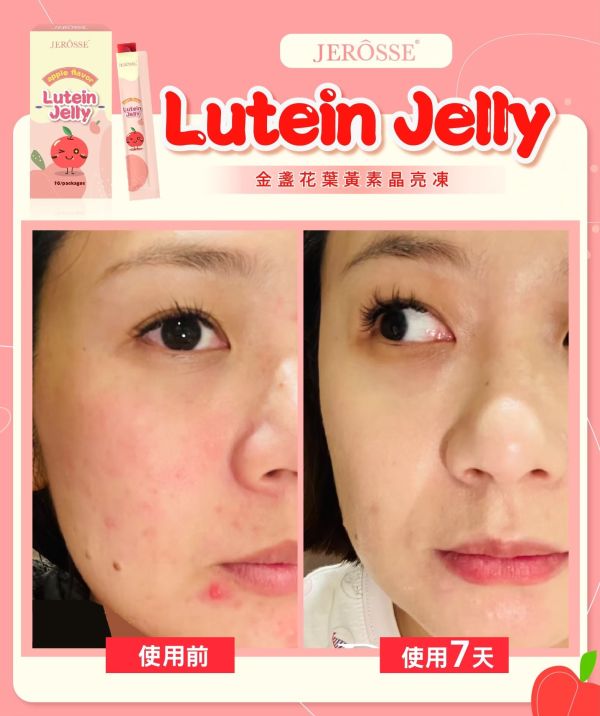 【年終慶】高機能益生菌和晶亮凍超值組 【夏日對策】水光繃帶面膜精裝盒超值組,水光繃帶面膜,水光面膜,婕樂纖