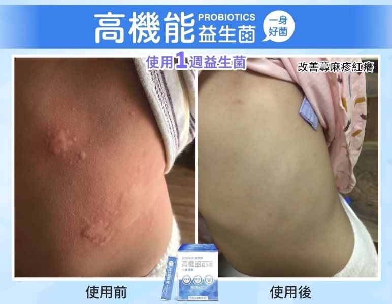 【年終慶】高機能益生菌和晶亮凍超值組 【夏日對策】水光繃帶面膜精裝盒超值組,水光繃帶面膜,水光面膜,婕樂纖