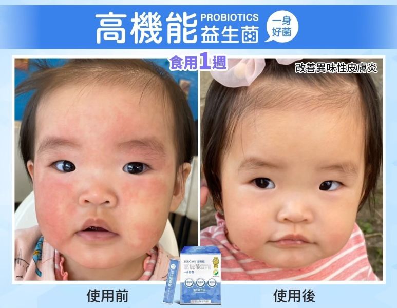 【年終慶】高機能益生菌和晶亮凍超值組 【夏日對策】水光繃帶面膜精裝盒超值組,水光繃帶面膜,水光面膜,婕樂纖