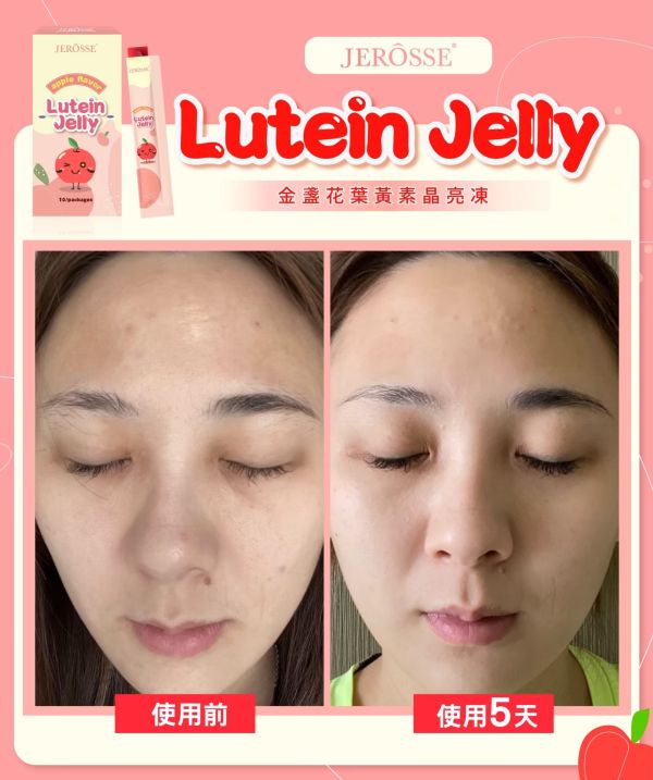 【年終慶】高機能益生菌和晶亮凍超值組 【夏日對策】水光繃帶面膜精裝盒超值組,水光繃帶面膜,水光面膜,婕樂纖