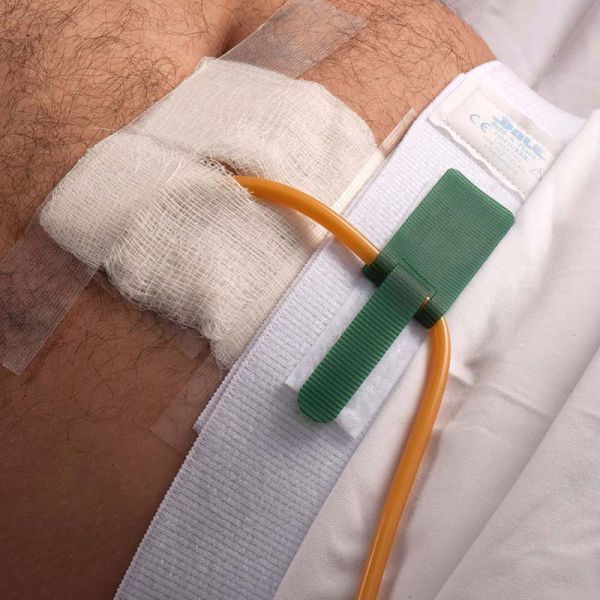 伊材 導尿管固定帶-腰部  (入) 