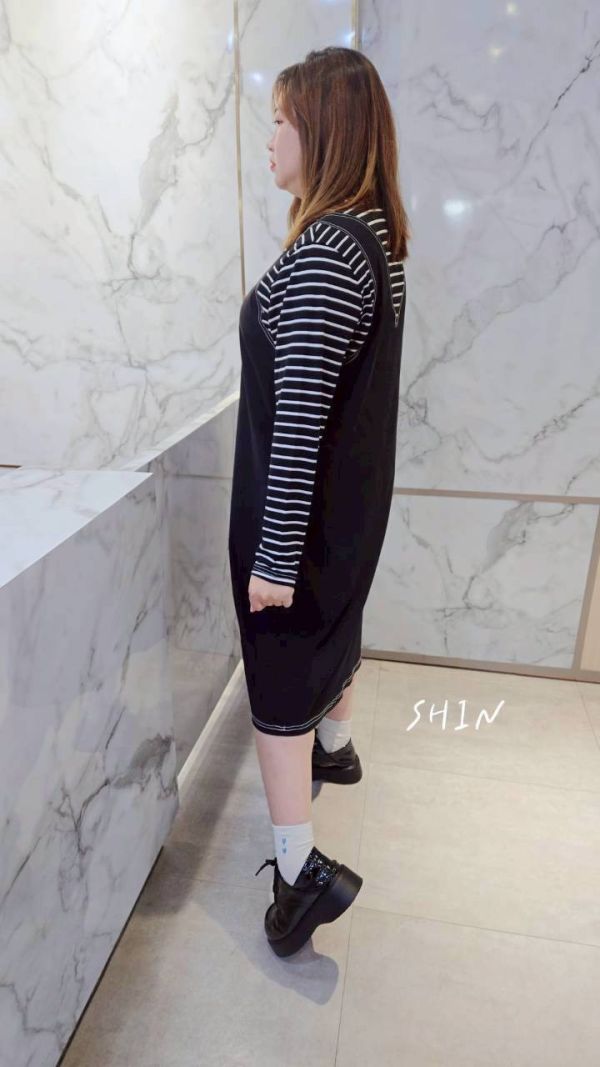 長版控超愛條紋車線洋 