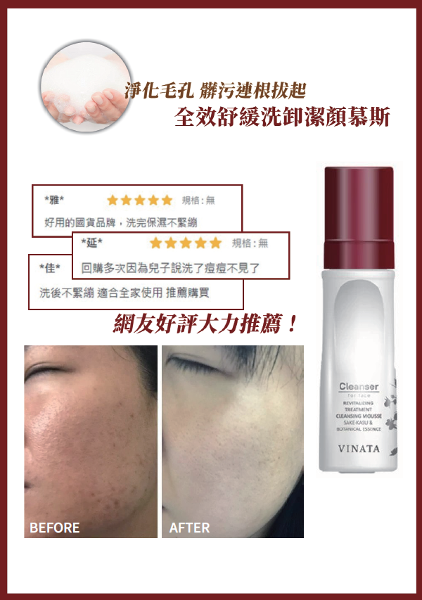 0093【台糖生技】全效舒緩洗卸潔顏慕斯180ml-D99 