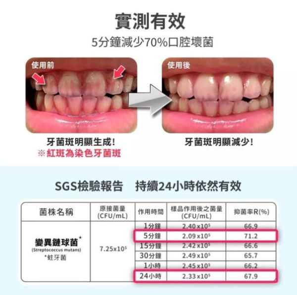 齒妍堂 兒童含鈣健齒噴霧PLUS 