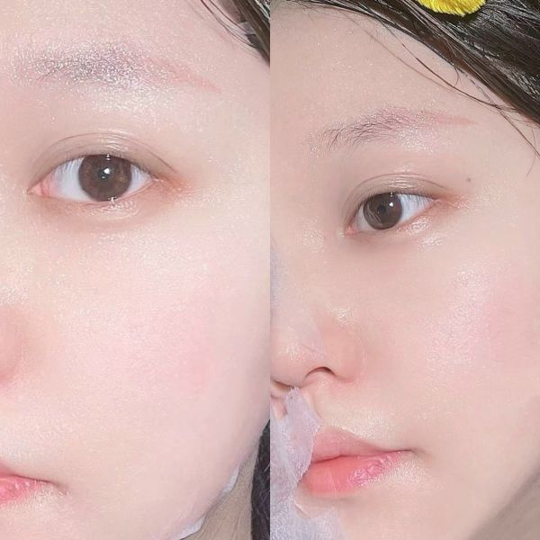 MEDIPEEL 玫瑰玻尿酸膠原蛋白面膜 30ml*50片/盒 (27) 