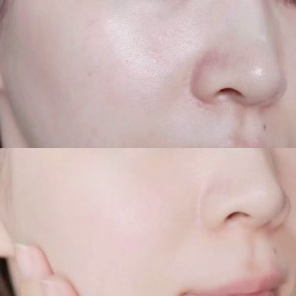 LA MER 海藍之謎 超能修護精華露 15ml (27/09) 