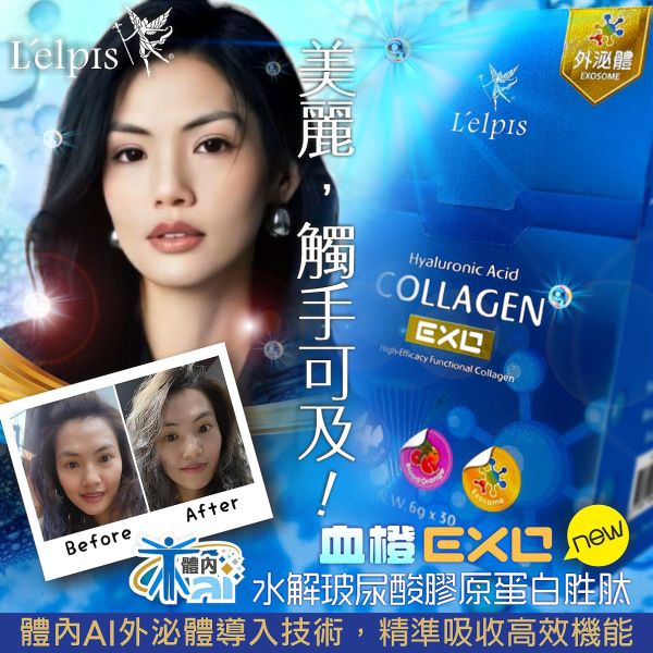 麗歐沛詩 血橙EXO玻尿酸水解膠原蛋白胜肽 生命之源補給站,銀髮族關節保健組合,乾眼症,近視,眼睛疾病,飛蚊症,譜偉酮飲,生酮捷徑,麗歐沛詩, 王者傳奇,預防醫學,預防保健,健康,抗衰,退化性關節炎,生酮,睡眠問題,減肥,疲勞,發炎,肝問題,美肌,防曬,血液循環