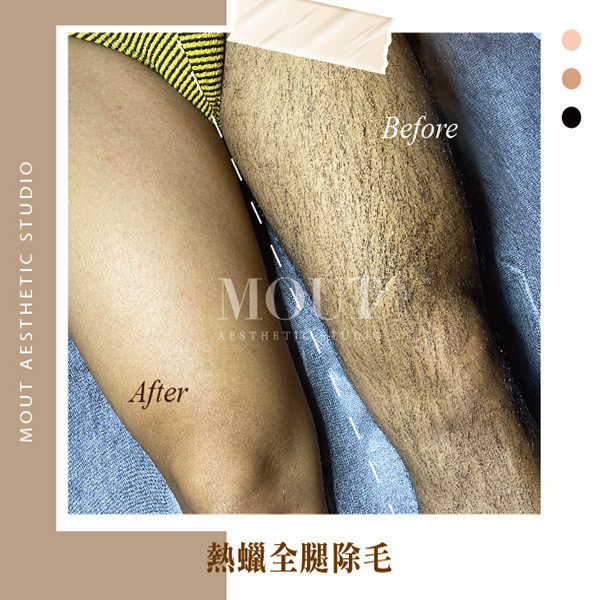 男士熱蠟美肌除毛 