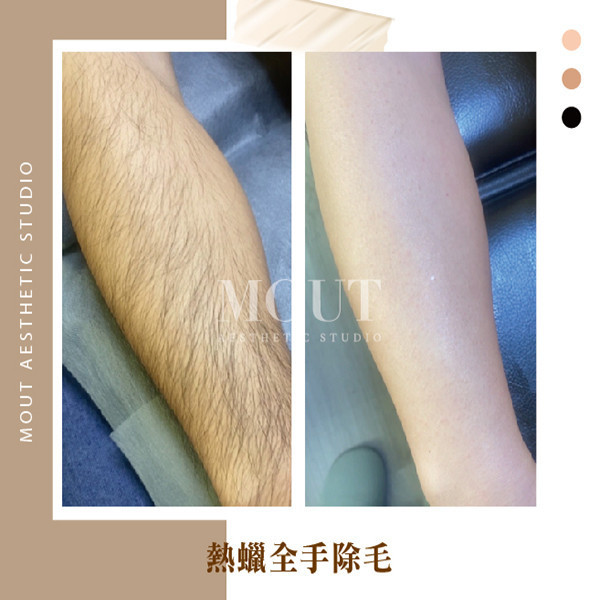 男士熱蠟美肌除毛 