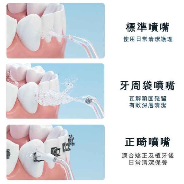 夏帕 SHOPA】X5／P6 沖牙機替換噴嘴｜原廠噴頭配件｜適用 SHOPA 沖牙機 沖牙機噴嘴
沖牙機噴頭
沖牙機替換噴嘴
水牙線噴嘴
水牙線噴頭
沖牙機配件
沖牙機耗材
沖牙機替換配件
原廠噴嘴
原廠噴頭
替換噴嘴
替換噴頭
牙縫清潔
牙齦沖洗
口腔護理
水柱清潔
口腔清潔配件
可拆式噴嘴
日常口腔保養